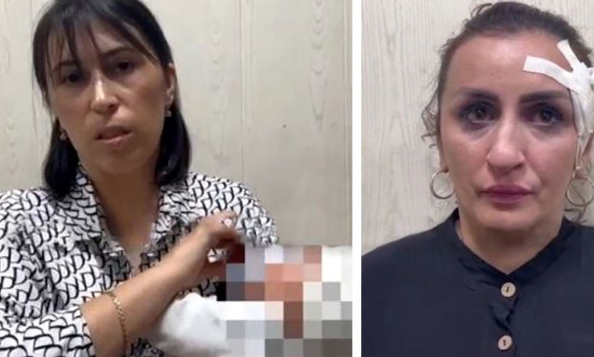 🔹مادری که متهم به فروش نوزاد پنج روزه خود به قیمت کمتر از ۳,۵۰۰ دلار است، گفته است که قصد داشت آن را برای عمل زیبایی بینی خود خرج کند. این زن ۳۳ ساله که نامش در گزارش های محلی ذکر نشده است، قبل از انجام عمل جراحی در داغستان در جنوب روسیه دستگیر شد.تو