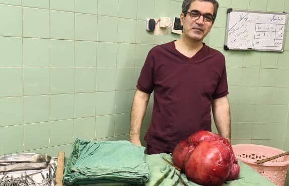 خارج کردن توده ۱۰ کیلوگرمی از شکم بیمار در بیمارستان شهید انصاری رودسر خارج کردن توده ۱۰ کیلوگرمی از شکم بیمار در بیمارستان شهید انصاری رودسر